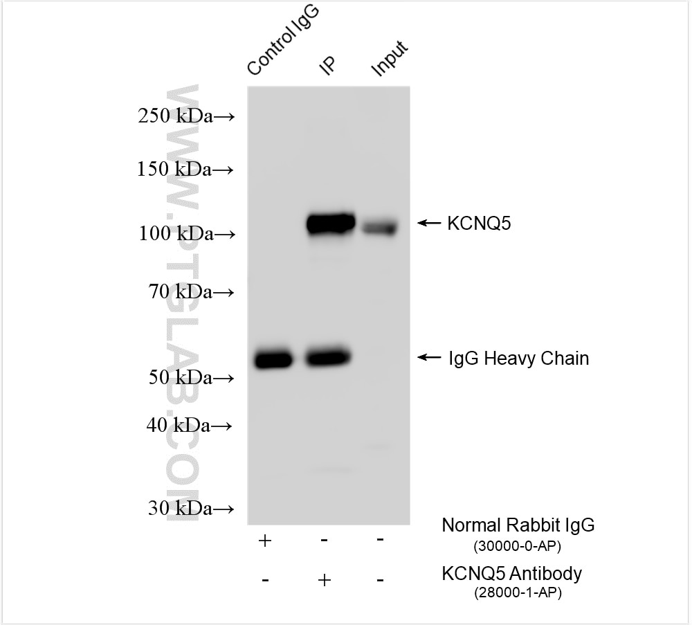 Immunoprecipitation (IP) experiment of Raji cells using KCNQ5 Polyclonal antibody (28000-1-AP)