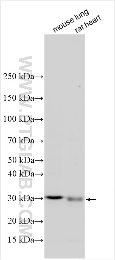 KCNRG
