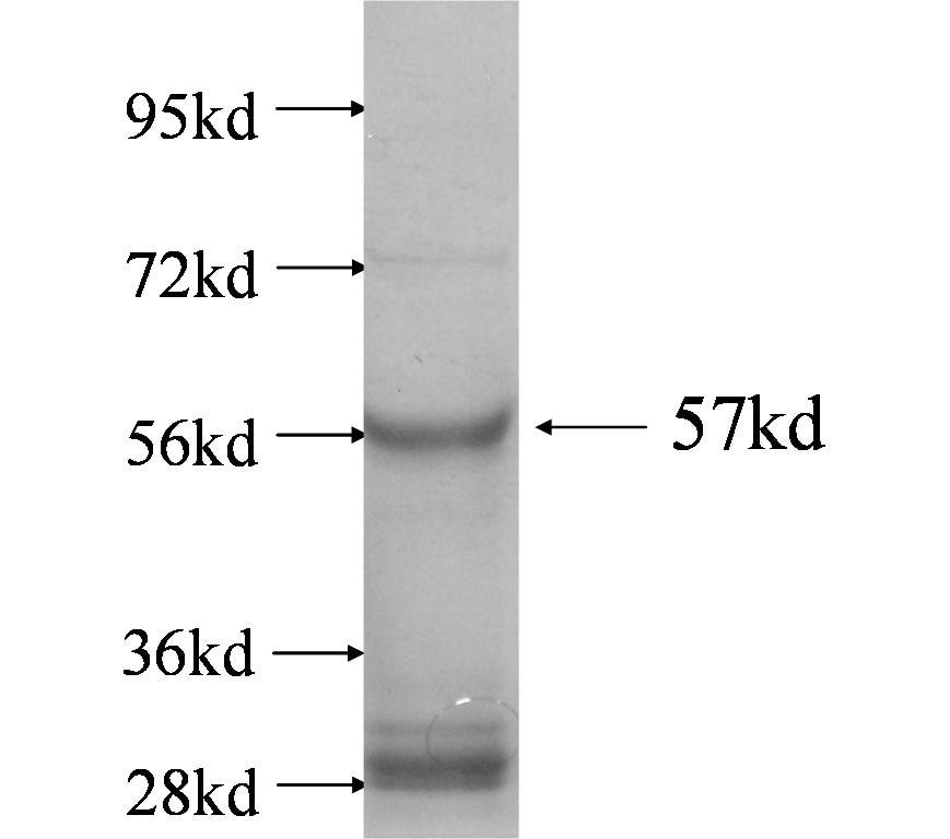 KCNRG fusion protein Ag4176 SDS-PAGE
