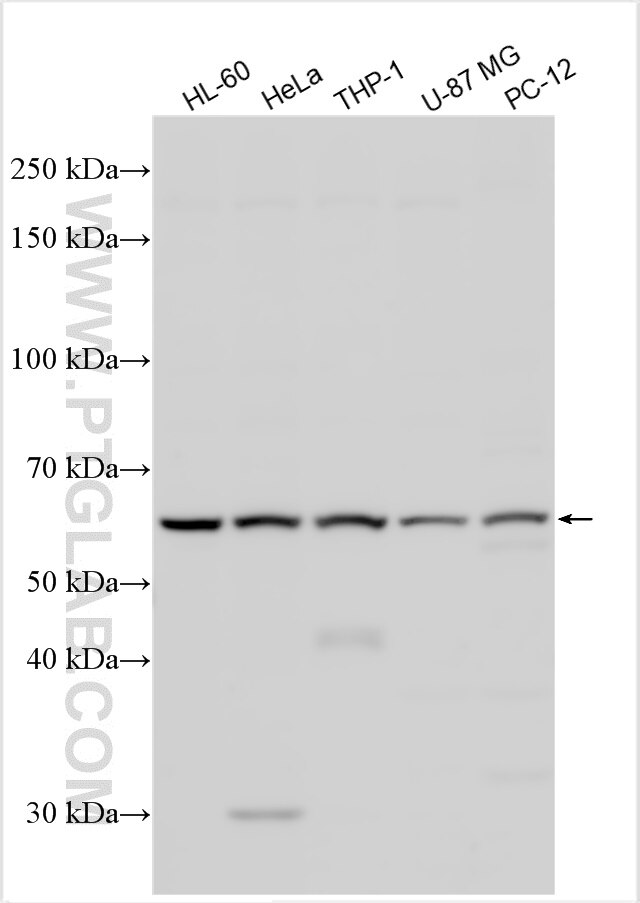 Western Blot (WB) analysis of various lysates using KCNS1 Polyclonal antibody (29988-1-AP)