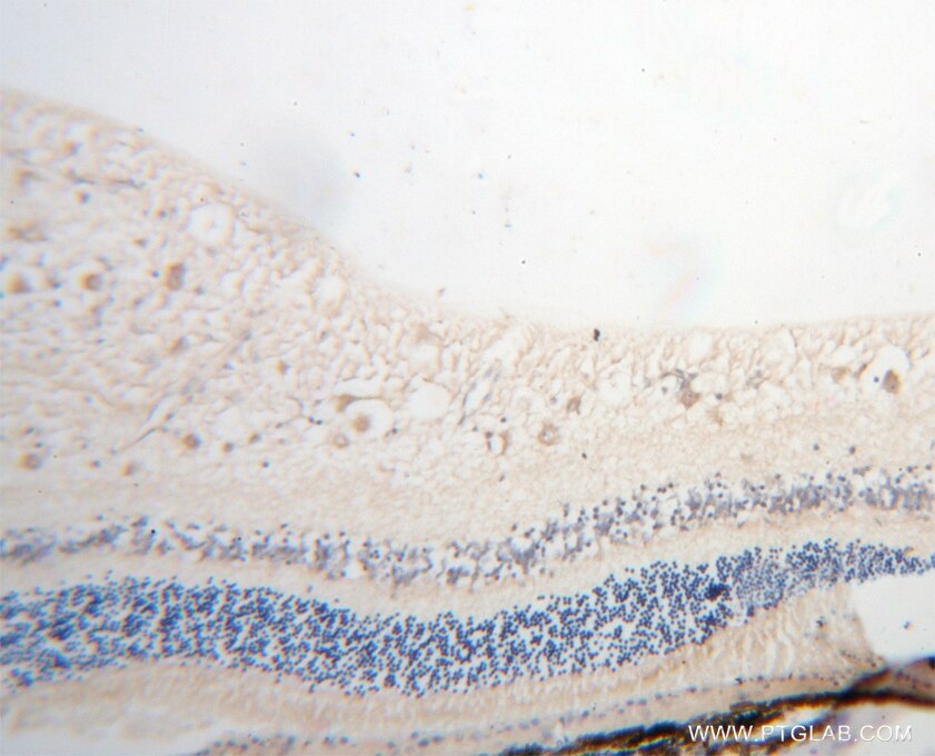 IHC staining of human eye using 13443-1-AP