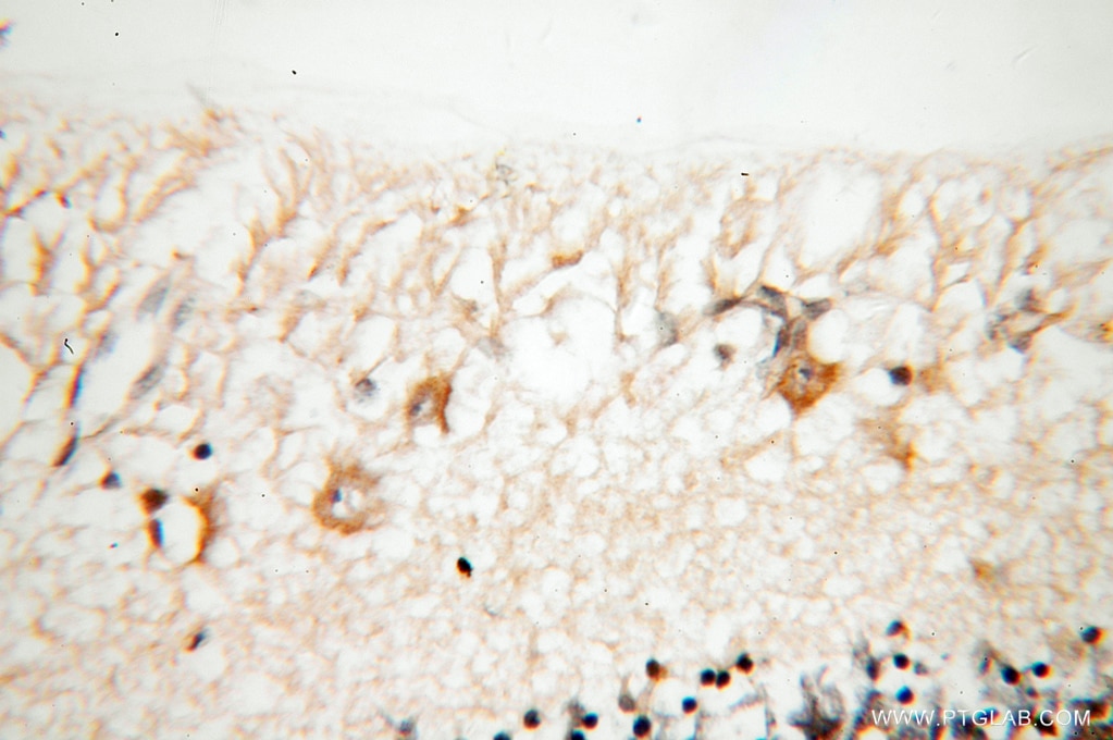 Immunohistochemistry (IHC) staining of human eye tissue using KCNS2 Polyclonal antibody (13443-1-AP)