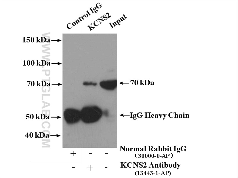 Immunoprecipitation (IP) experiment of HepG2 cells using KCNS2 Polyclonal antibody (13443-1-AP)