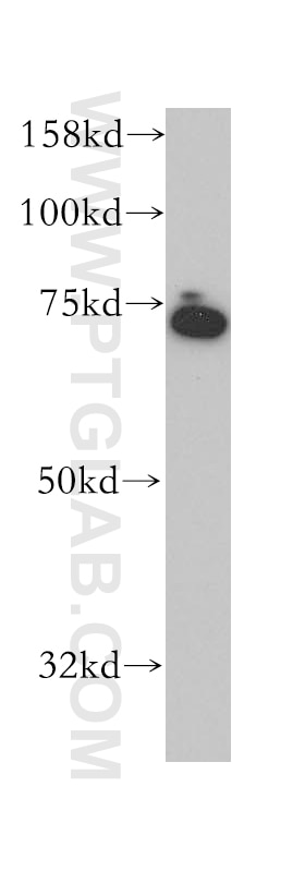 Western Blot (WB) analysis of Y79 cells using KCNS2 Polyclonal antibody (13443-1-AP)