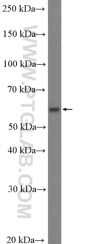 Western Blot (WB) analysis of human placenta tissue using KCNS3 Polyclonal antibody (10092-1-AP)