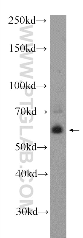 Western Blot (WB) analysis of SH-SY5Y cells using KCNV1 Polyclonal antibody (12684-1-AP)