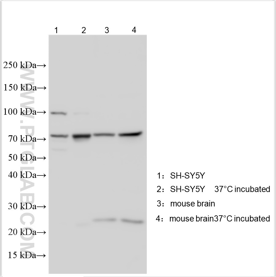 Western Blot (WB) analysis of various lysates using KCNV1 Polyclonal antibody (12684-1-AP)
