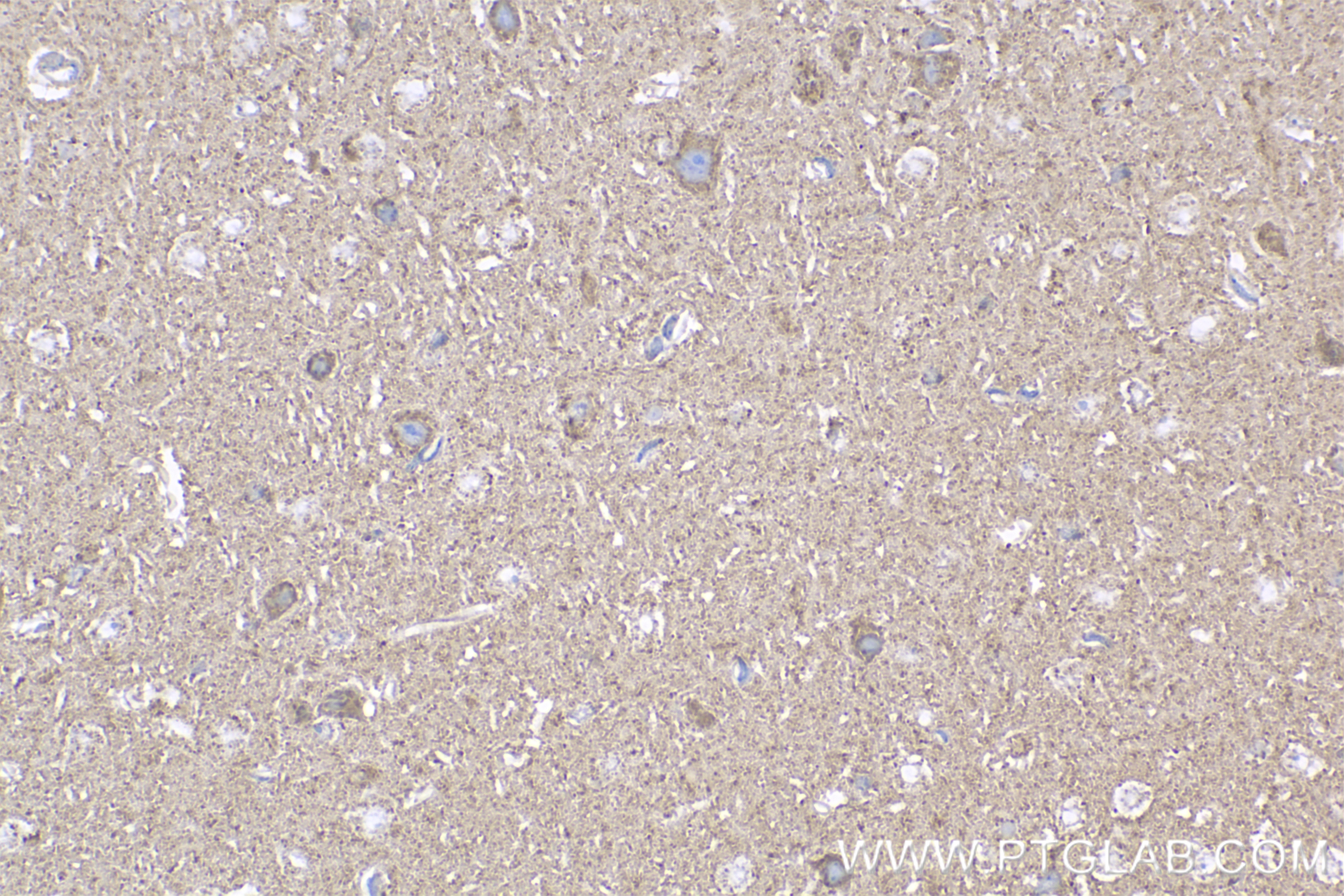 Immunohistochemical analysis of paraffin-embedded mouse brain tissue slide using 85153-3-RR (KCNV1 antibody) at dilution of 1:600 (under 40x lens). Heat mediated antigen retrieval with Tris-EDTA buffer (pH 9.0). Immunohistochemistry (IHC) staining of mouse brain tissue using KCNV1 Recombinant monoclonal antibody (85153-3-RR)