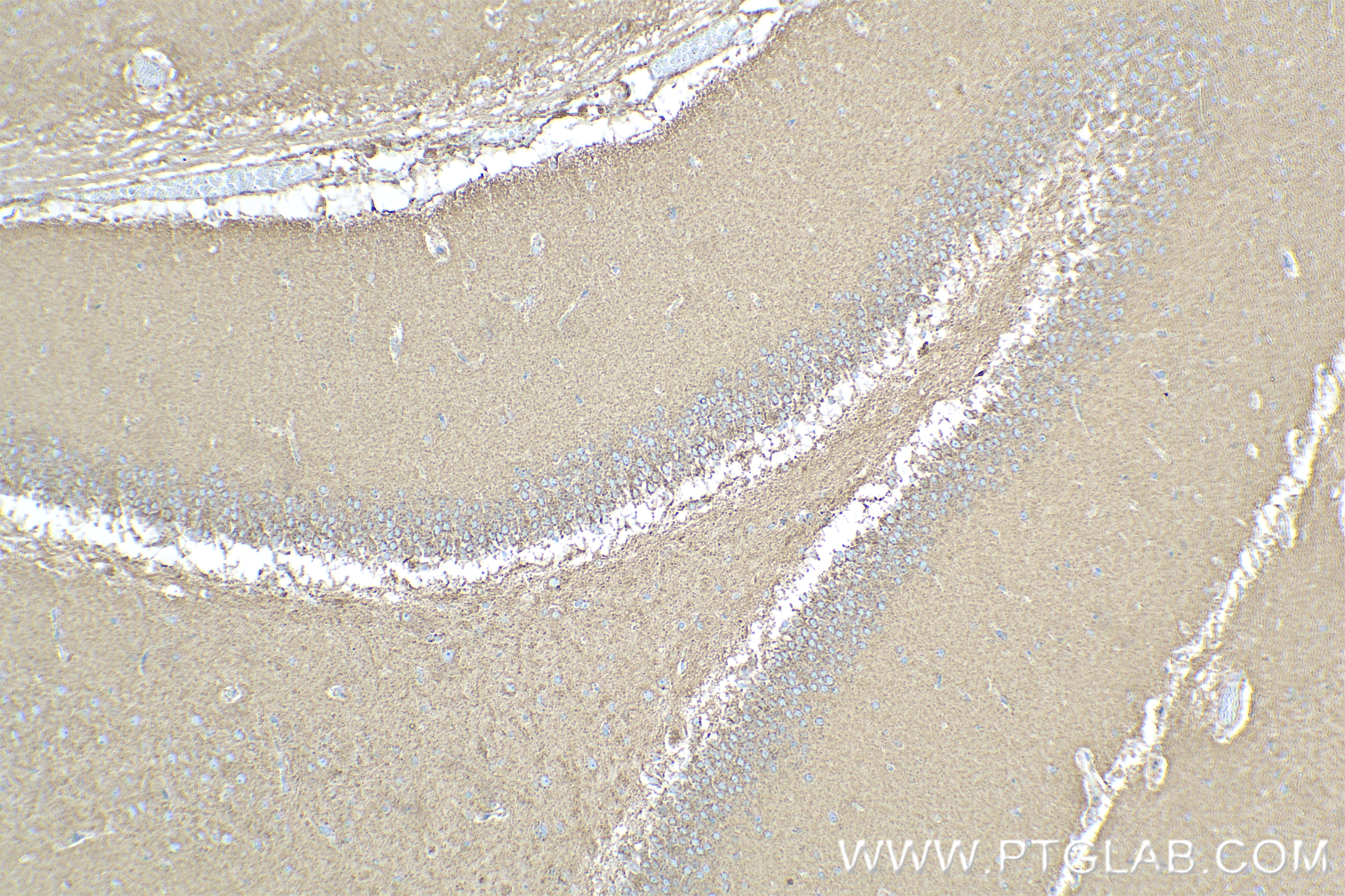 Immunohistochemical analysis of paraffin-embedded rat brain tissue slide using 85153-3-RR (KCNV1 antibody) at dilution of 1:600 (under 10x lens). Heat mediated antigen retrieval with Tris-EDTA buffer (pH 9.0). Immunohistochemistry (IHC) staining of rat brain tissue using KCNV1 Recombinant monoclonal antibody (85153-3-RR)