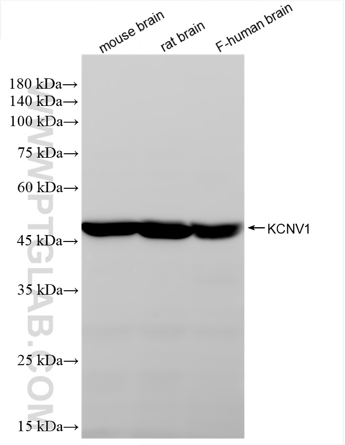 Western Blot (WB) analysis of various lysates using KCNV1 Recombinant antibody (85153-3-RR)