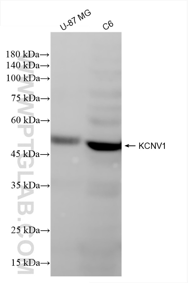 Western Blot (WB) analysis of various lysates using KCNV1 Recombinant antibody (85153-3-RR)