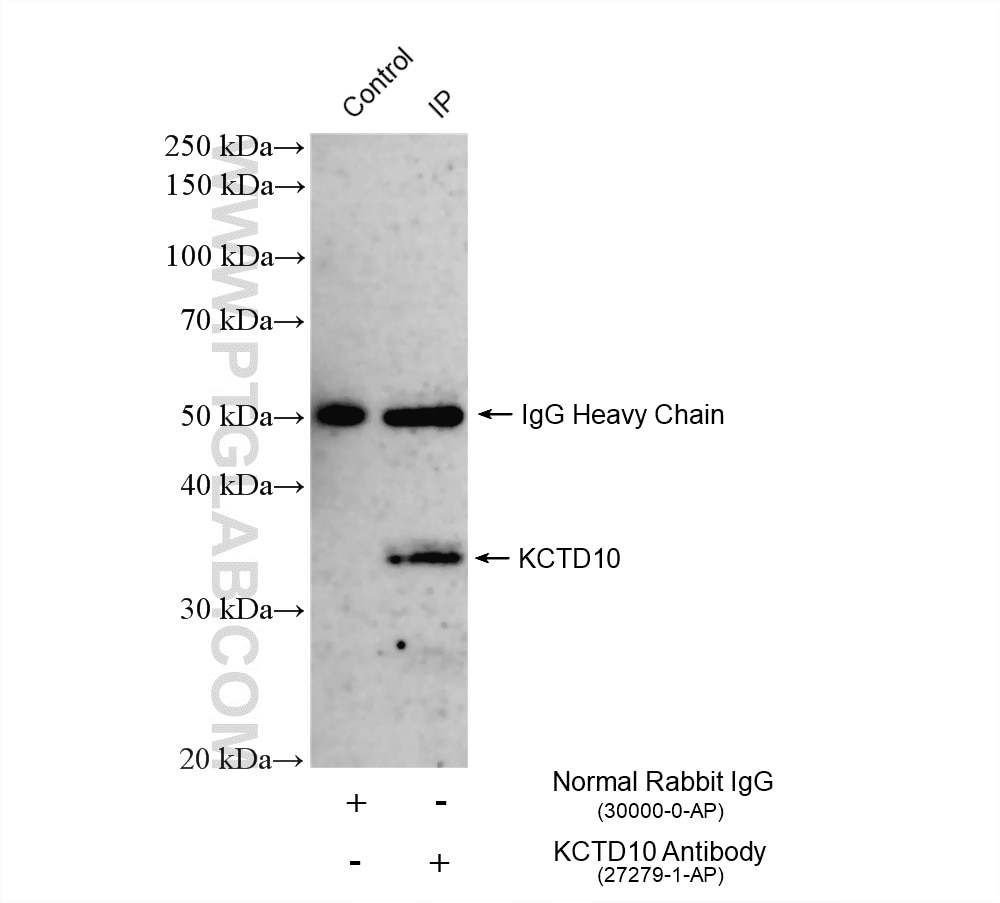 Immunoprecipitation (IP) experiment of HuH-7 cells using KCTD10 Polyclonal antibody (27279-1-AP)