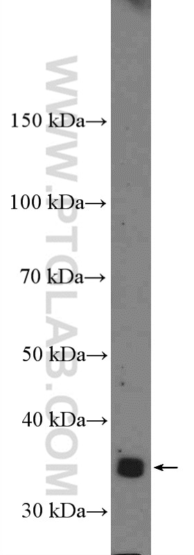Western Blot (WB) analysis of HeLa cells using KCTD10 Polyclonal antibody (27279-1-AP)