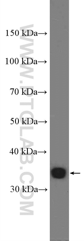 Western Blot (WB) analysis of Jurkat cells using KCTD10 Polyclonal antibody (27279-1-AP)