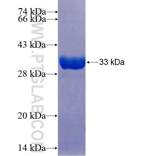 KCTD10 fusion protein Ag25971 SDS-PAGE