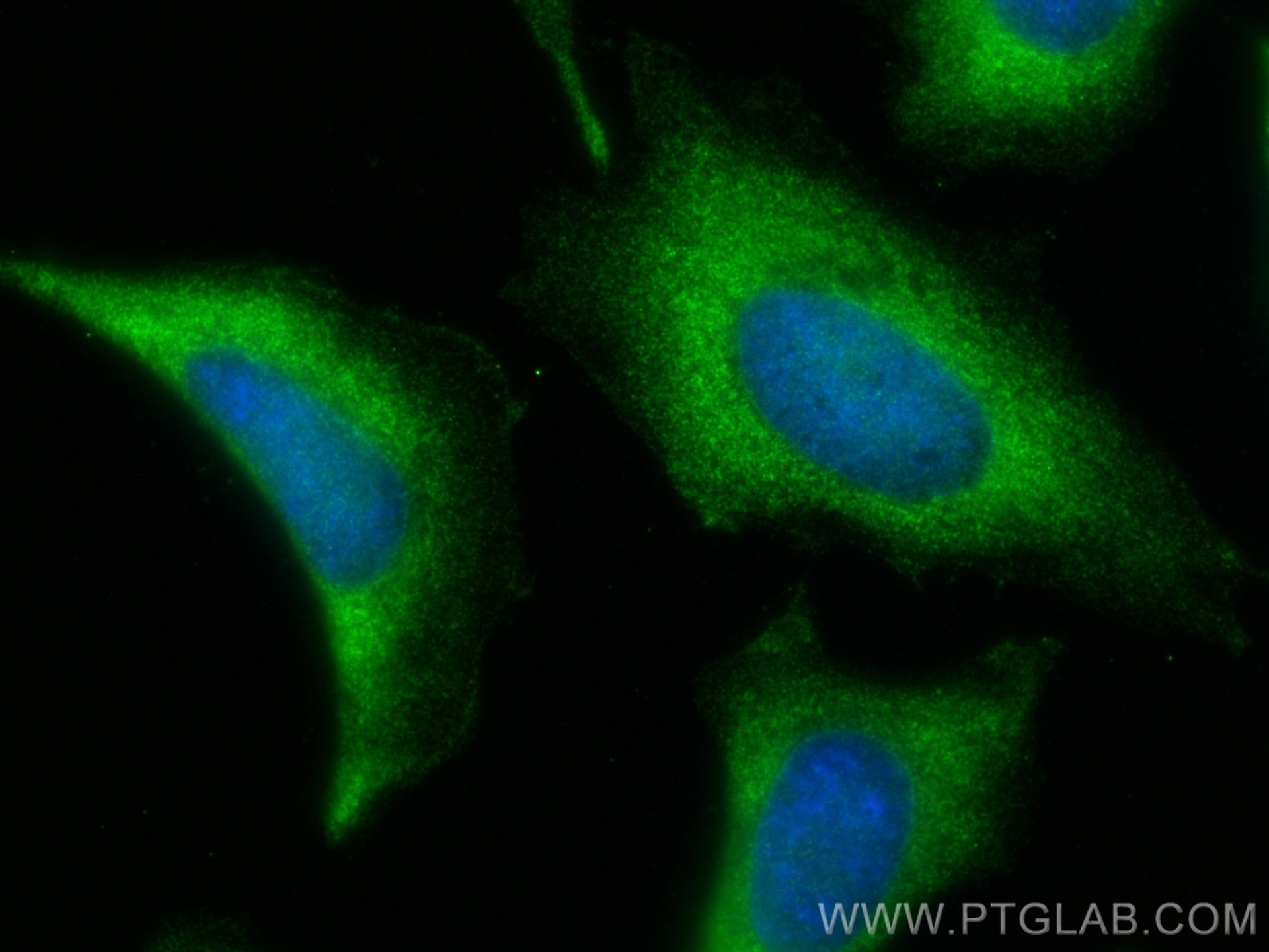 Immunofluorescence (IF) / fluorescent staining of HeLa cells using KCTD12 Polyclonal antibody (15523-1-AP)