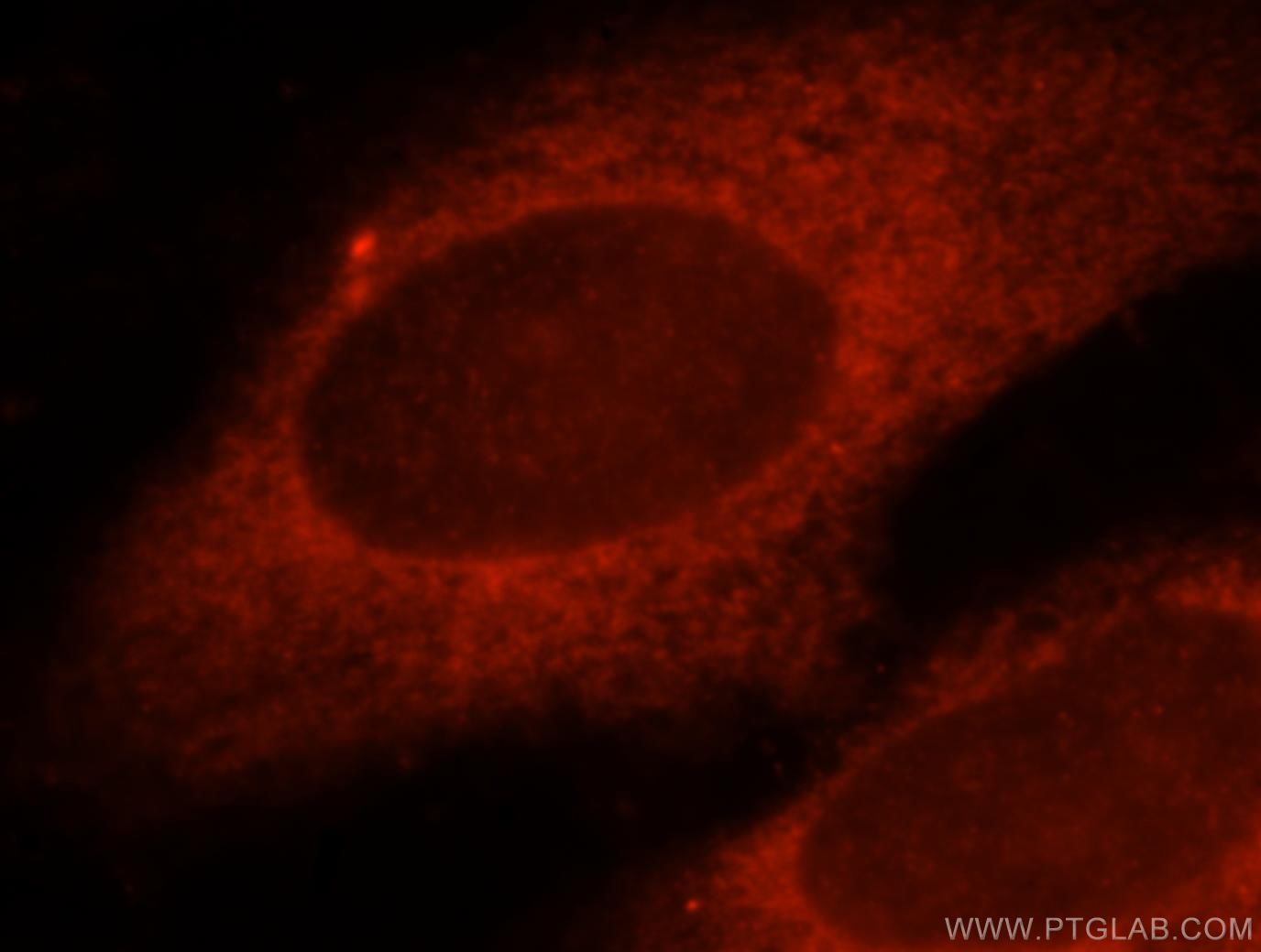 Immunofluorescence (IF) / fluorescent staining of HeLa cells using KCTD12 Polyclonal antibody (15523-1-AP)