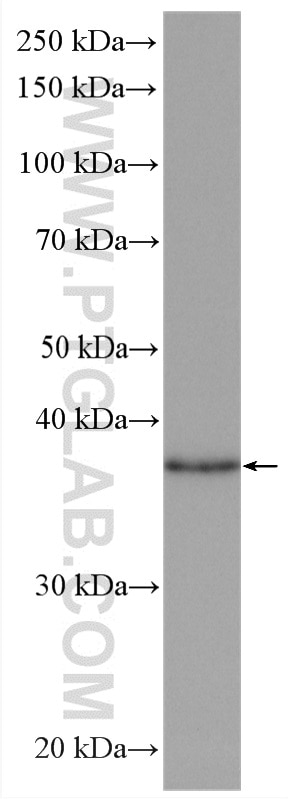 Western Blot (WB) analysis of rat brain tissue using KCTD12 Polyclonal antibody (15523-1-AP)