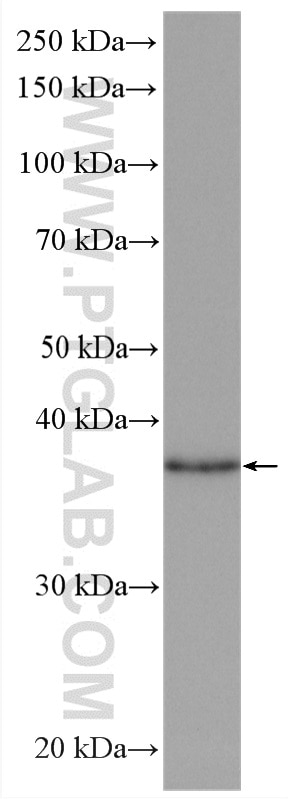 WB analysis of rat brain using 15523-1-AP