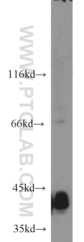 Western Blot (WB) analysis of mouse brain tissue using KCTD12 Polyclonal antibody (15523-1-AP)