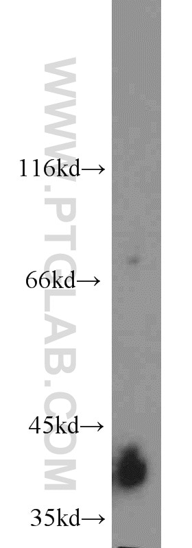 Western Blot (WB) analysis of MCF-7 cells using KCTD12 Polyclonal antibody (15523-1-AP)