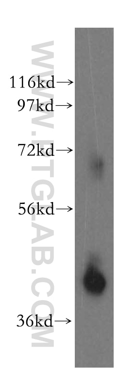 Western Blot (WB) analysis of human brain tissue using KCTD12 Polyclonal antibody (15523-1-AP)