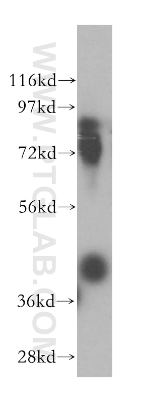 Western Blot (WB) analysis of HEK-293 cells using KCTD12 Polyclonal antibody (15523-1-AP)