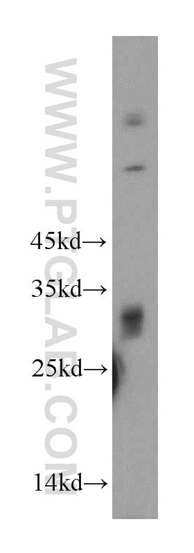 Western Blot (WB) analysis of mouse brain tissue using KCTD14 Polyclonal antibody (21111-1-AP)