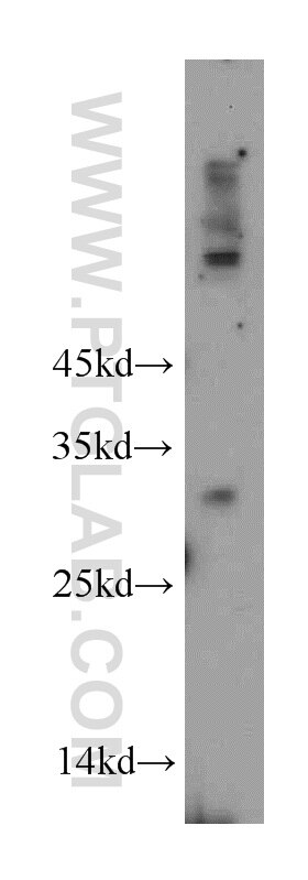 Western Blot (WB) analysis of mouse small intestine tissue using KCTD14 Polyclonal antibody (21111-1-AP)