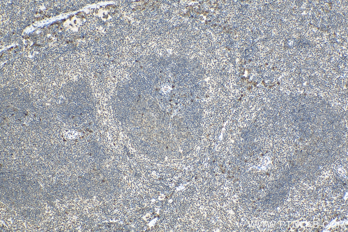 IHC staining of mouse spleen using 20128-1-AP
