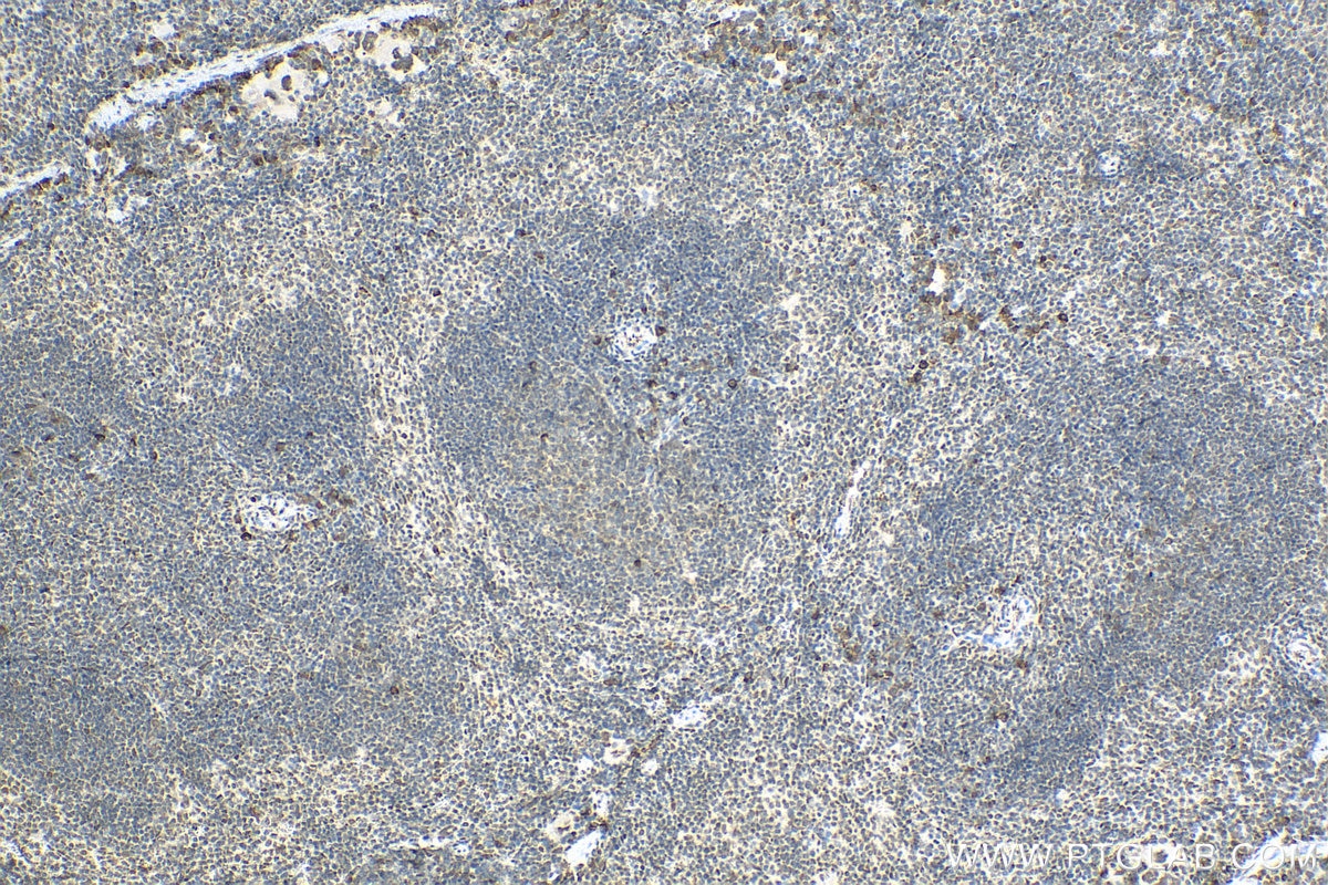 Immunohistochemistry (IHC) staining of mouse spleen tissue using KCTD15 Polyclonal antibody (20128-1-AP)