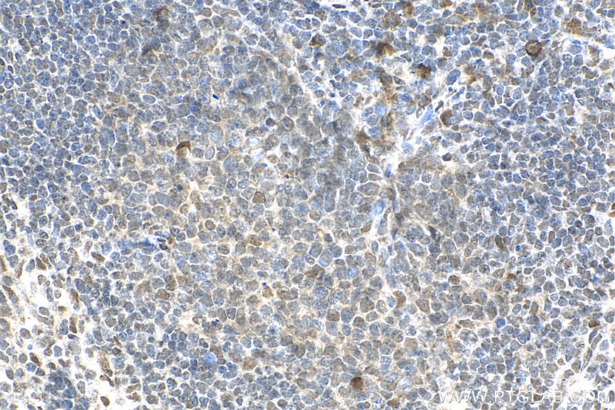 Immunohistochemistry (IHC) staining of mouse spleen tissue using KCTD15 Polyclonal antibody (20128-1-AP)