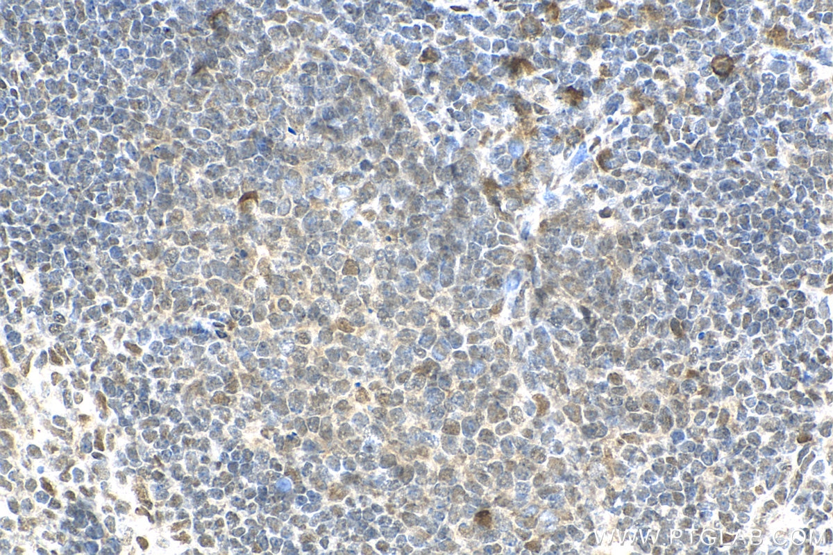 Immunohistochemistry (IHC) staining of mouse spleen tissue using KCTD15 Polyclonal antibody (20128-1-AP)