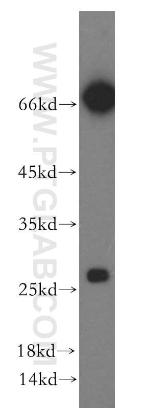 Western Blot (WB) analysis of HEK-293 cells using KCTD15 Polyclonal antibody (20128-1-AP)