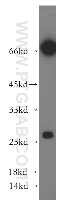 Western Blot (WB) analysis of HEK-293 cells using KCTD15 Polyclonal antibody (20128-1-AP)