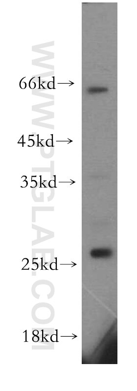 Western Blot (WB) analysis of mouse lung tissue using KCTD15 Polyclonal antibody (20128-1-AP)