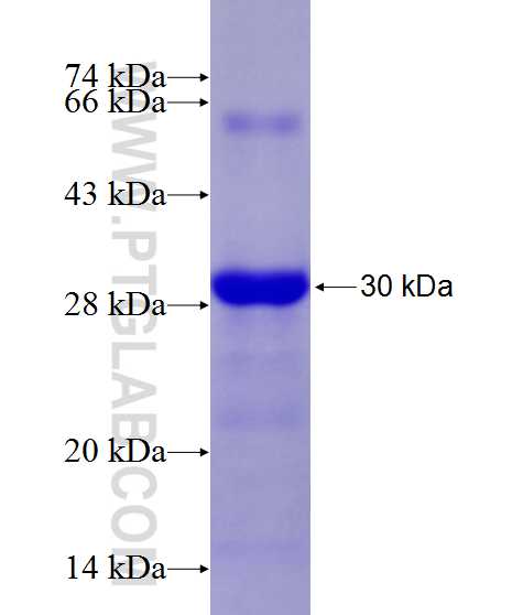 KCTD15 fusion protein Ag13962 SDS-PAGE