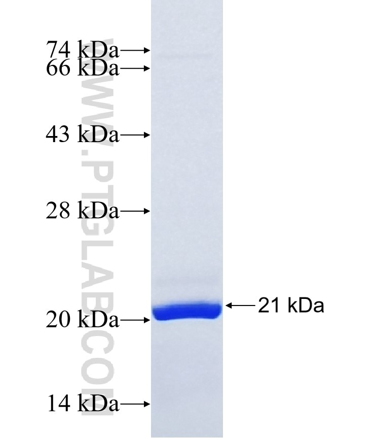 KCTD19 fusion protein Ag36697 SDS-PAGE KCTD19 fusion protein Ag36697 SDS-PAGE