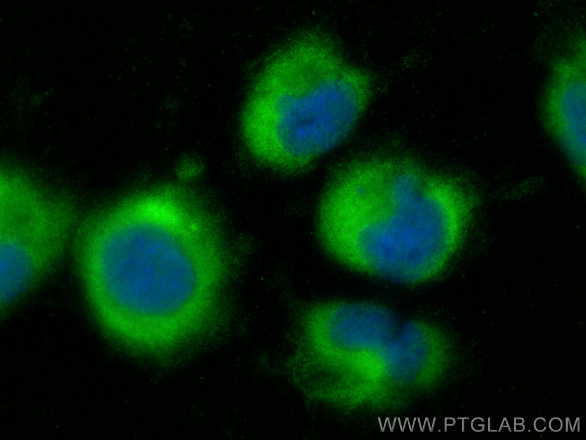 IF Staining of U-251 using 32728-1-AP Immunofluorescence (IF) / fluorescent staining of U-251 cells using KCTD20 Polyclonal antibody (32728-1-AP)