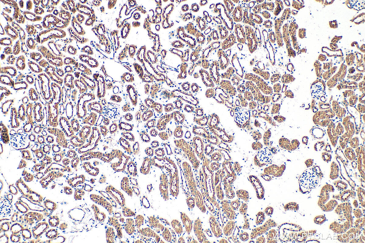 IHC staining of mouse kidney using 32728-1-AP Immunohistochemistry (IHC) staining of mouse kidney tissue using KCTD20 Polyclonal antibody (32728-1-AP)