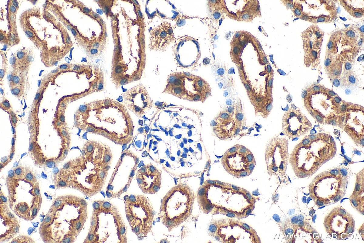 IHC staining of mouse kidney using 32728-1-AP Immunohistochemistry (IHC) staining of mouse kidney tissue using KCTD20 Polyclonal antibody (32728-1-AP)