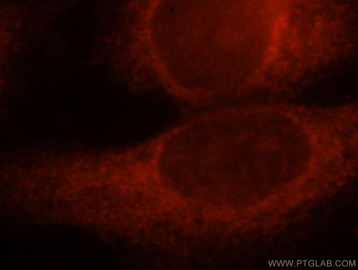 Immunofluorescence (IF) / fluorescent staining of HeLa cells using KCTD2/5/17 Polyclonal antibody (15553-1-AP)