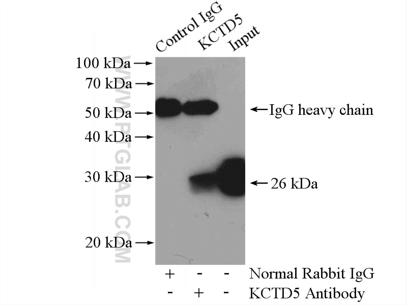 Immunoprecipitation (IP) experiment of HeLa cells using KCTD2/5/17 Polyclonal antibody (15553-1-AP)