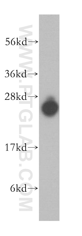 Western Blot (WB) analysis of human brain tissue using KCTD2/5/17 Polyclonal antibody (15553-1-AP)