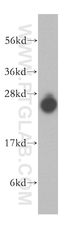 WB analysis of human brain using 15553-1-AP