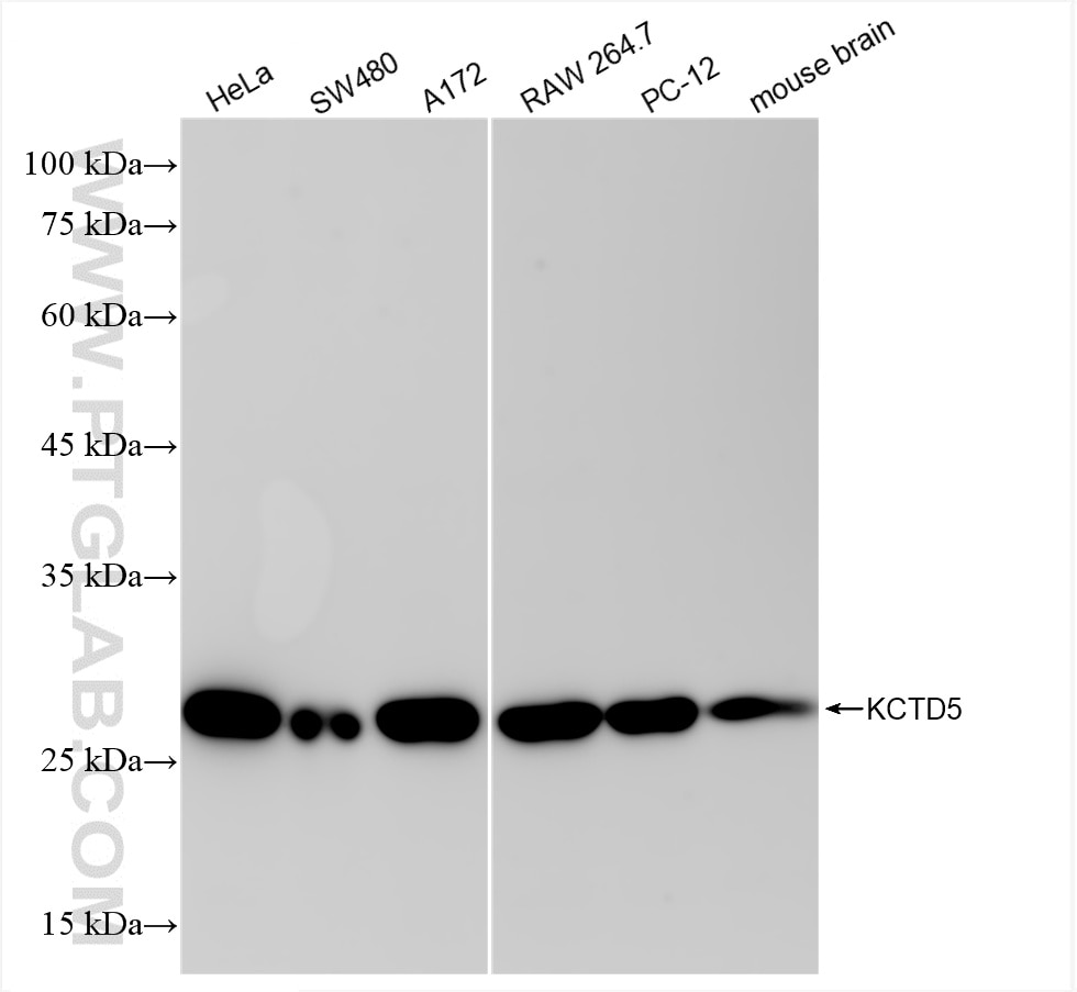 Western Blot (WB) analysis of various lysates using KCTD5 Recombinant antibody (85210-5-RR)