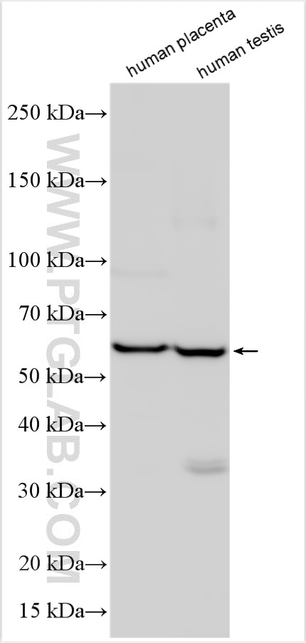 Western Blot (WB) analysis of various lysates using KCTD7 Polyclonal antibody (32488-1-AP)