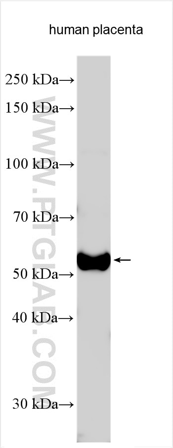 Western Blot (WB) analysis of various lysates using KCTD8 Polyclonal antibody (23197-1-AP)
