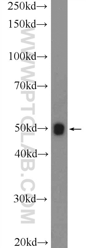 Western Blot (WB) analysis of SMMC-7721 cells using KDELC1 Polyclonal antibody (17018-1-AP)