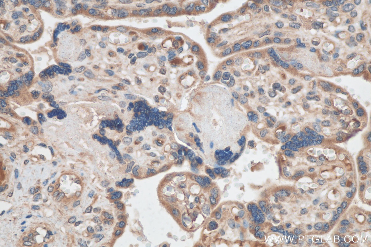 Immunohistochemistry (IHC) staining of human placenta tissue using KDELC2 Polyclonal antibody (23345-1-AP)
